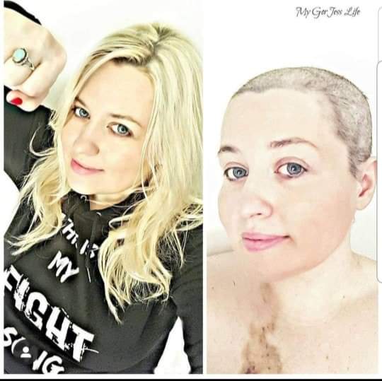A split image showing a woman with long blonde hair on the left, confidently posing with a fist, and on the right, the same woman with a shaved head, showcasing resilience and strength.